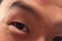 脑门肿了!孙兴慜被人推撞到了奖杯,但孙哥高兴得合不拢嘴